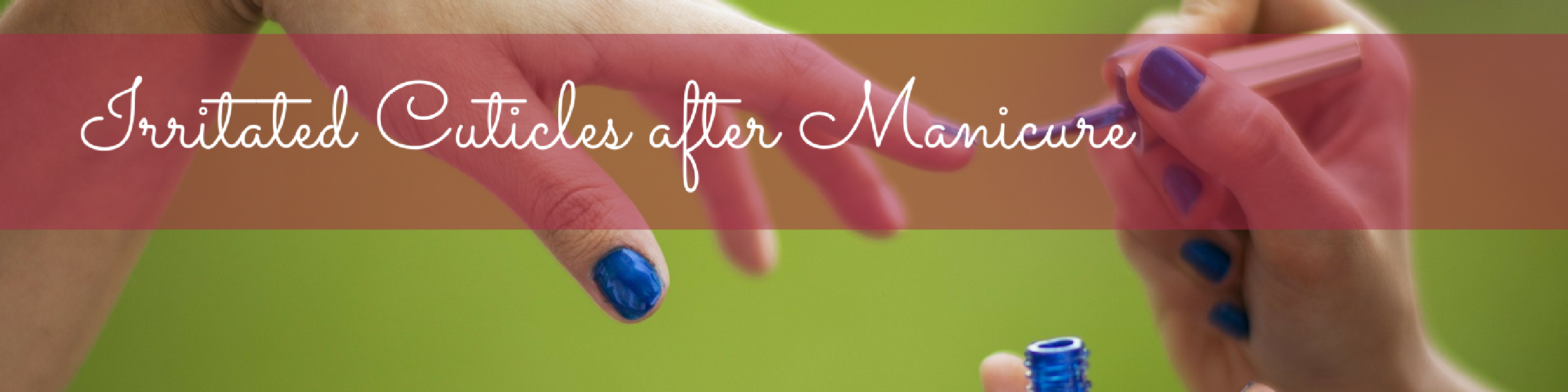 Irritated Cuticles after Manicure